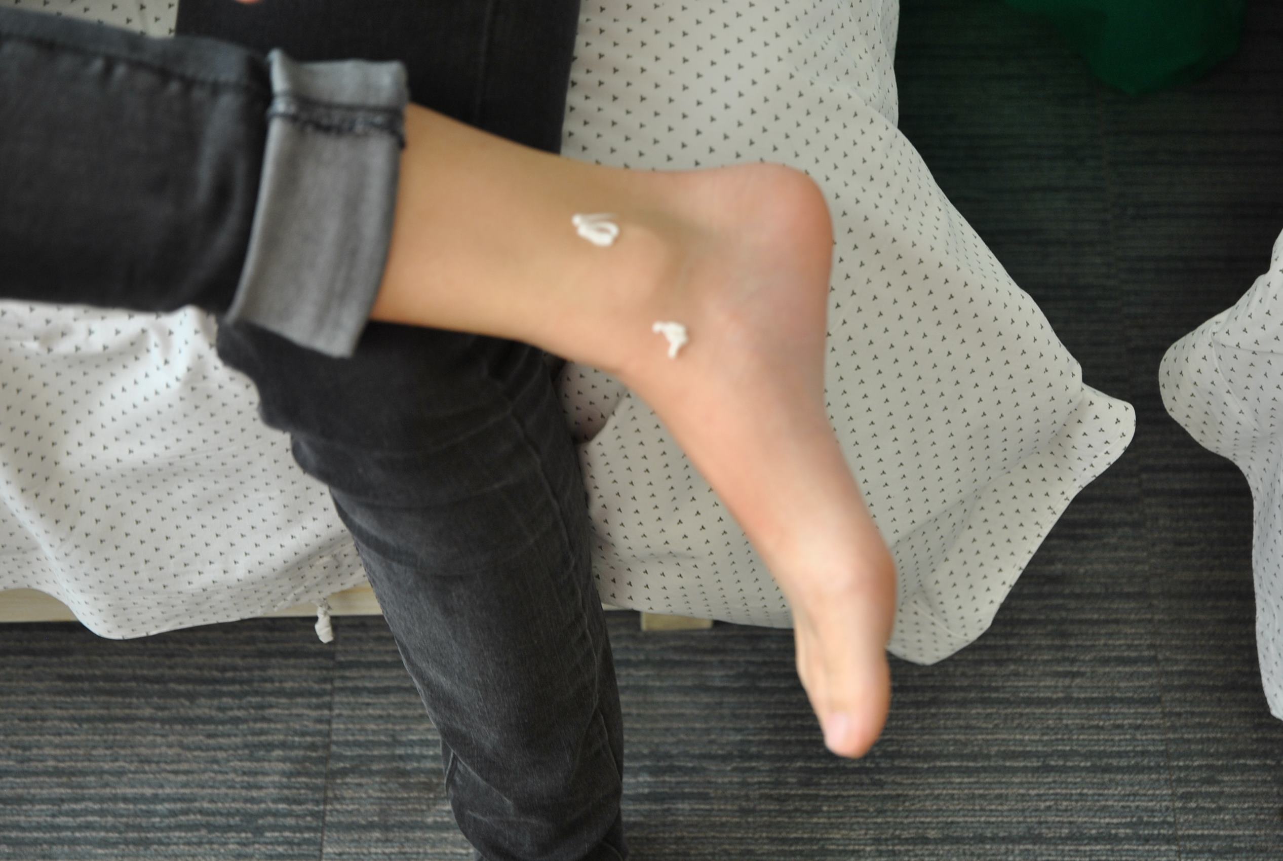 图片[2]-自由摄影 No.170 受伤了玉足 [51P]-萌味圈